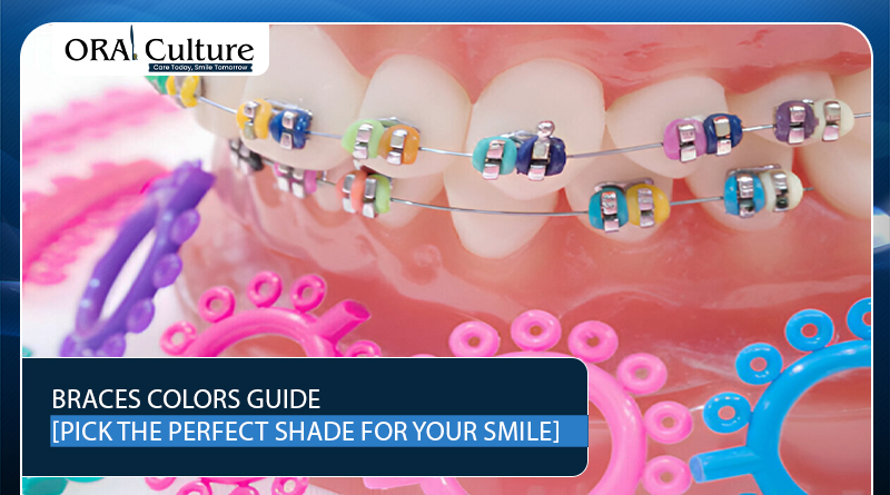 Explore our Braces Colors Guide to choose the perfect shade that complements your smile and personality.