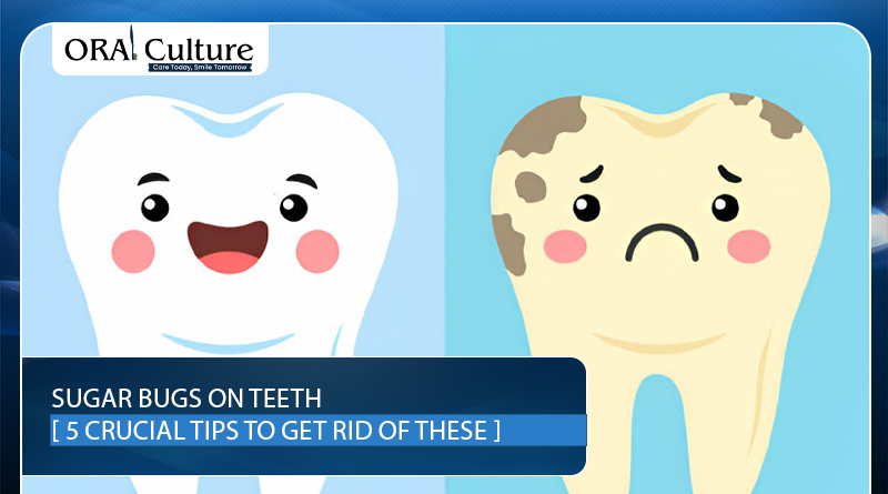 Sugar bugs feeding on leftover sugar on a child’s teeth — Learn 5 essential ways to remove them and protect your smile.