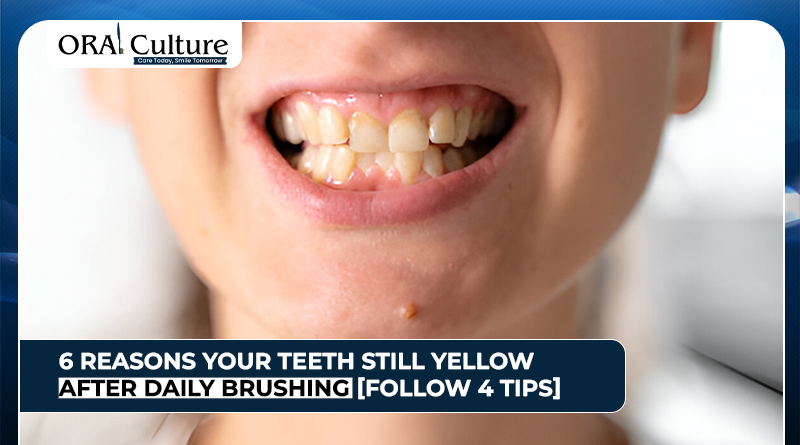 Yellow teeth shown despite brushing daily for oral care