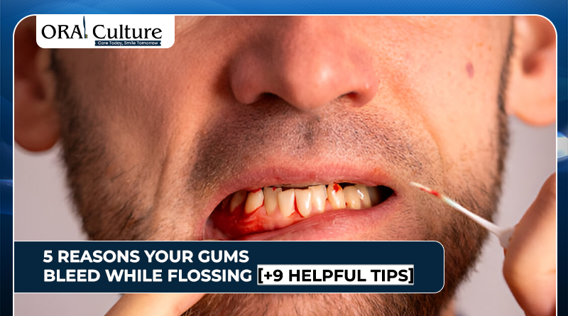 Why gums bleed while flossing and tips to stop it