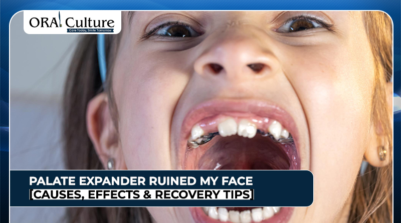 Palate expander ruined my face showing facial changes after orthodontic expansion